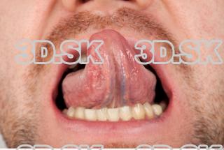 Tongue texture of Vendelin 0002